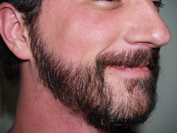 Рост бороды по дням с фото